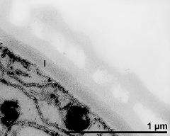 interapertural area of pollen wall