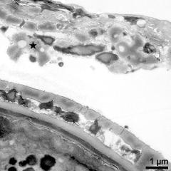 pollen wall (bottom) and tapetum cells with Ubisch bodies (asterisk)