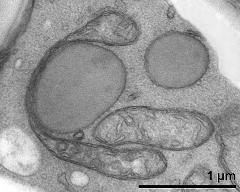 mitochondria and lipids in vegetative cytoplasm