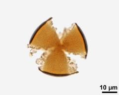 acetolyzed pollen, lower focus