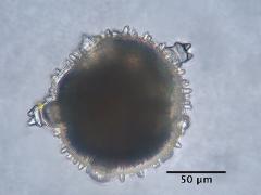 hydrated pollen,apertures with operculum