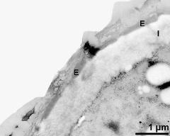 apertural area of pollen wall