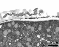 pollen wall at transition of aperture and interapertural area