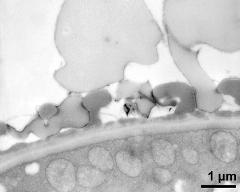 interapertural area of pollen wall