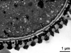 pollen wall, interapertural area