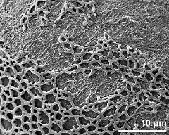 sulcus border