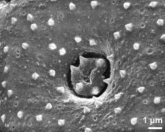 aperture of dry pollen grain