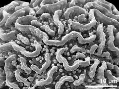 exine surface