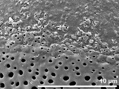 sulcus border