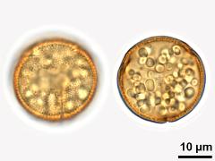 acetolyzed pollen