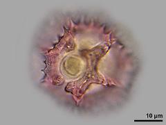 hydrated pollen,equatorial view