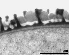 pollen wall, interapertural area