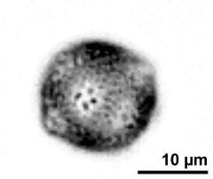 upper focus