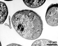 pollen grains in cross section