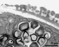 pollen wall, transition of aperture to interapertural area