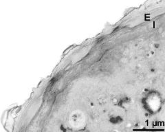 apertural area of pollen wall, intine (I), endexine (E)