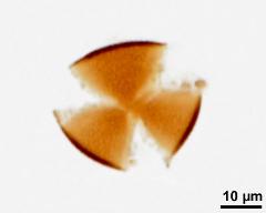 acetolyzed pollen, lower focus