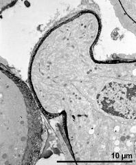 germinating pollen grain (aperture)