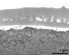 interapertural area of pollen wall