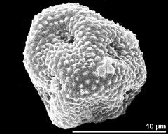 dry pollen grain in equatorial view