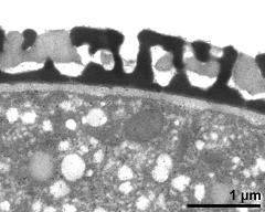 pollen wall, interapertural area