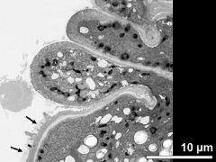 cytoplasmic protrusions and pollen wall (detail); primexine matrix on top of the pollen wall (arrows)