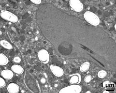 sperm cell (left) and vegetative nucleus with crystalline inclusions (protein bodies)