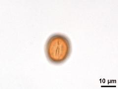 acetolyzed pollen,equatorial view