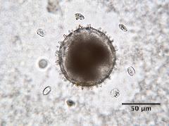 hydrated pollen,release of the operculi (satellites around the pollen grain)