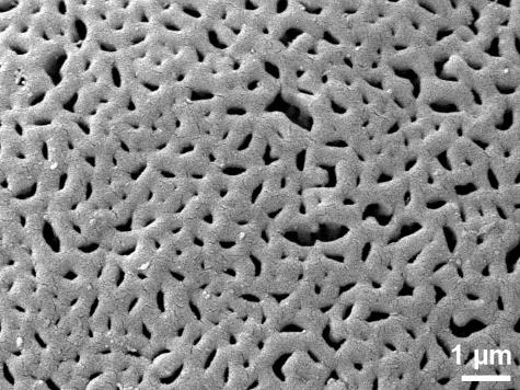 exine surface