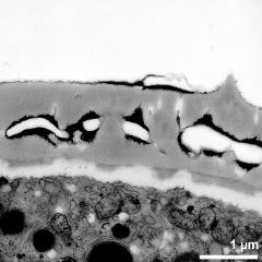 interapertural area of pollen wall