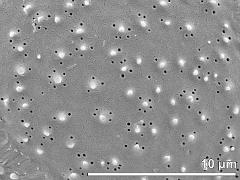 exine surface