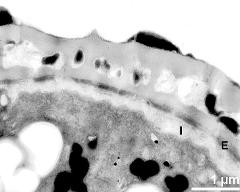 interapertural area of pollen wall, intine (I), endexine (E)