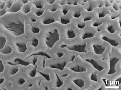 Sculpture in interapertural area,reticulate