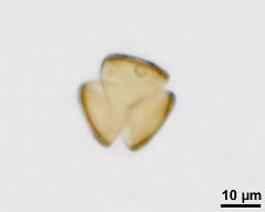 acetolyzed pollen,polar view,lower focus