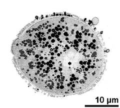 mature pollen grain; vegetative nucleus (asterisk) and generative cell