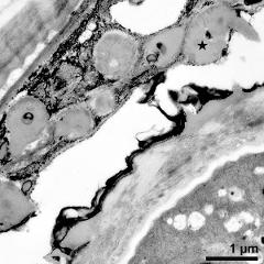 pollen wall and tapetum cells with Ubisch bodies (asterisk)