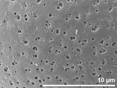 exine surface