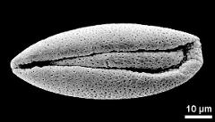 dry pollen grain in equatorial view