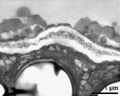 apertural area of pollen wall