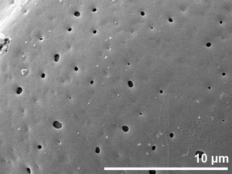 exine surface