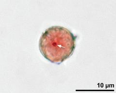 pollen grain with generative cell (arrow)