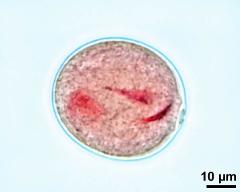 vegetative cell and sperm cells