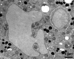 vegetative nucleus and generative cell