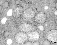 mitochondria in vegetative cytoplasm