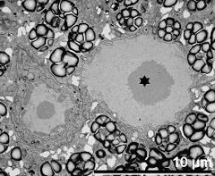 vegetative nucleus (asterisk) and generative cell; note starch grains within vegetative cytoplasm