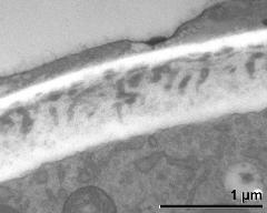 apertural area of pollen wall