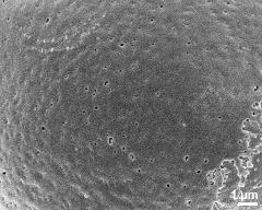 exine surface