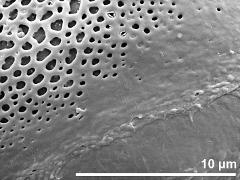 sulcus border