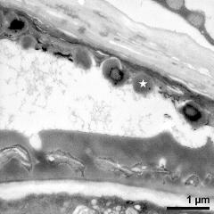 pollen wall (bottom) and tapetum cells with Ubisch bodies (asterisk)